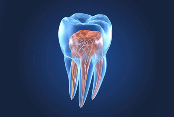 Best Root Canal Treatment