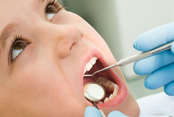 wisdom tooth extraction