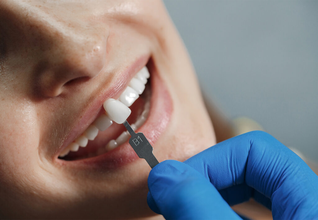 Dentists in Pitampura
