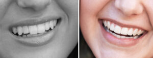 best dentist in lok vihar